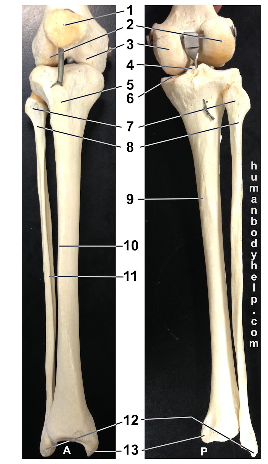 Lower Leg Bone Diagram / 11 Best Images of Blank Skeletal System